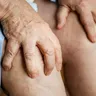Is CBG Good For Pain Management?