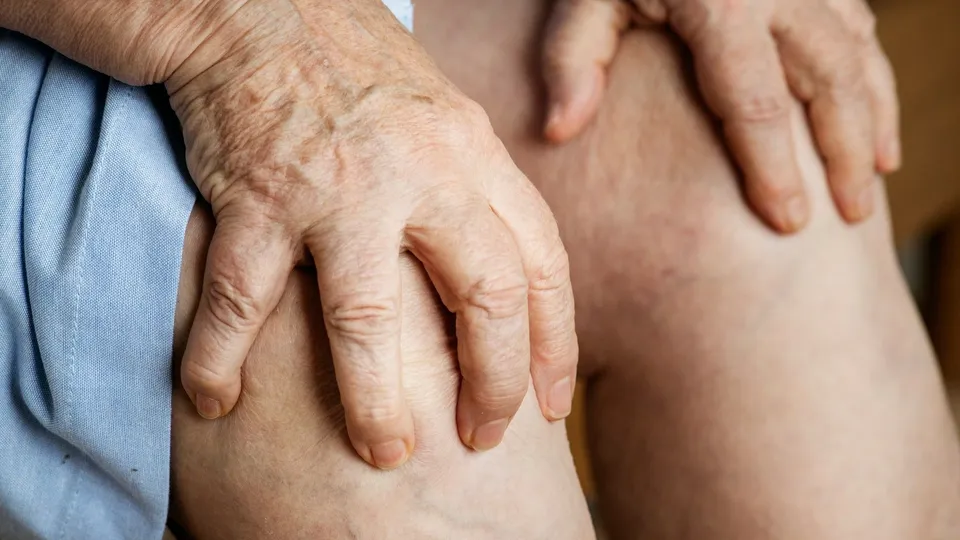 Is CBG Good For Pain Management?