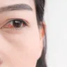 Why Does Weed Make Your Eyes Red?